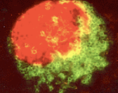 SickKidsNews's tweet photo. New #SKResearch by Dr. Jayne Danska in @ScienceTM identifies antibody responses against normal gut bacteria that assist in identification of children at risk for type one diabetes. #T1D
Read ➡️ https://t.co/bK6Q23idOg https://t.co/7X9x6sHhNu