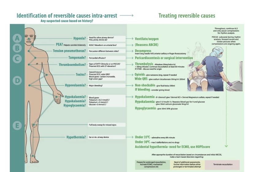 From <a href="/ResusJournal/">Resuscitation</a> resuscitationjournal.com/article/S0300-… #cpr #cardiacarrest #resus