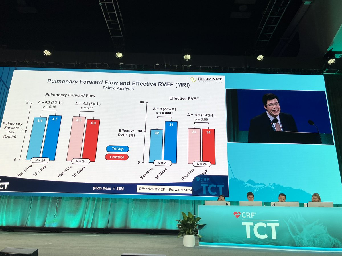 @JoaoLCavalcante showing favorable RV remodeling from Triclip #Triluminate imaging substudy @TCTMD #tct2023 @AbbottNews @MHIF_Heart @HamidNadira @JGrapsa @nickaram @vonBardelebenRS @hahn_rt @MarkusSchererMD @OKhaliqueMD