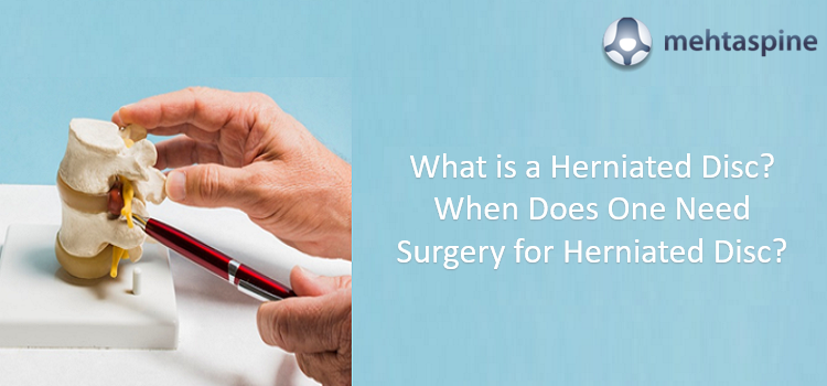 MehtaSpineUK's tweet image. A #spinaldisc is a jelly donut-type structure with the tougher fibrous outer layer and soft gel-like center. mehtaspine.co.uk/blog/what-is-a…
#mehtaspineuk