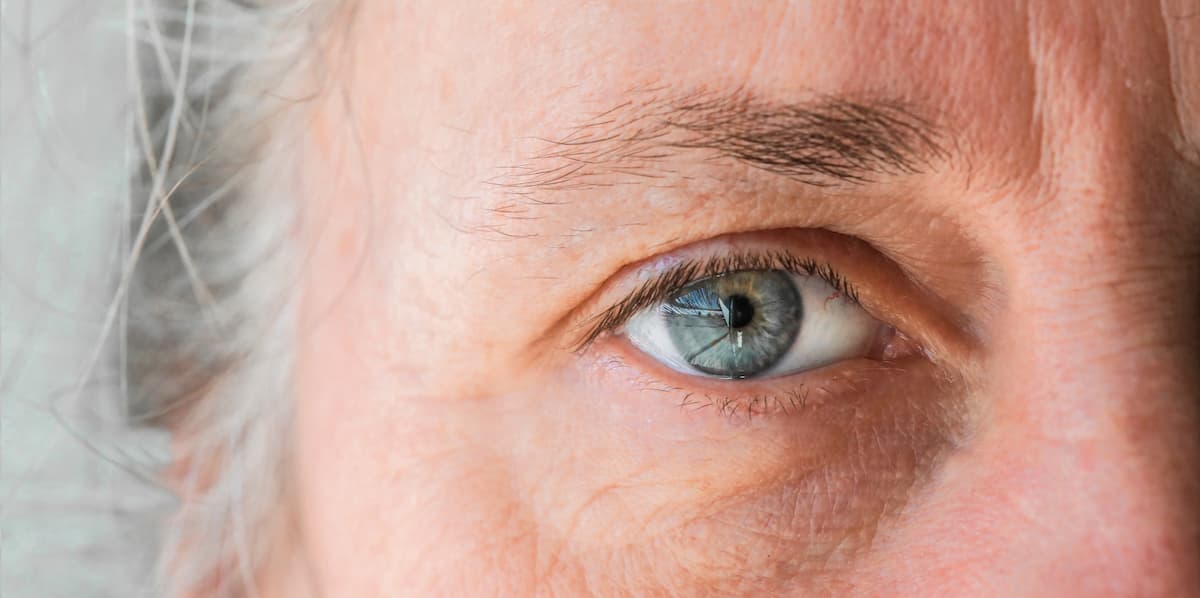 Many patients with Dry Eye Disease are 'silent sufferers,' not realizing their discomfort is treatable. Find out how a proactive approach can make a major impact.

Read More: ophthalmologytimes.com/view/are-your-…