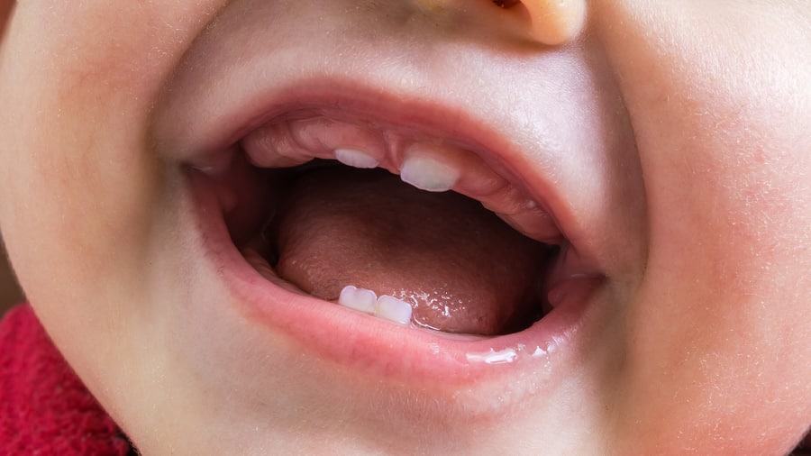 TorachDentist's tweet photo. Getting professional care of dentists is crucial for healthy development of your child’s teeth, mouth, gums. The first dental visit should take place 6 months after first eruption. Teething, tongue tie and other concerns will as well be addressed. Babies are  our responsibility. https://t.co/XmbSgwgnWH