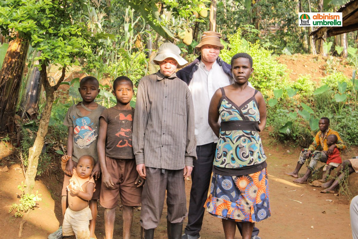albinismumbrell's tweet photo. Persons with albinism till today remain one of the most disadvantaged groups both academically and financially in Uganda because of the poverty, high rate of school dropout levels, discrimination and stigma.
We continue to call for inclusion in all sectors!
#AccessForAlbinism https://t.co/JDoZiD9Iu8