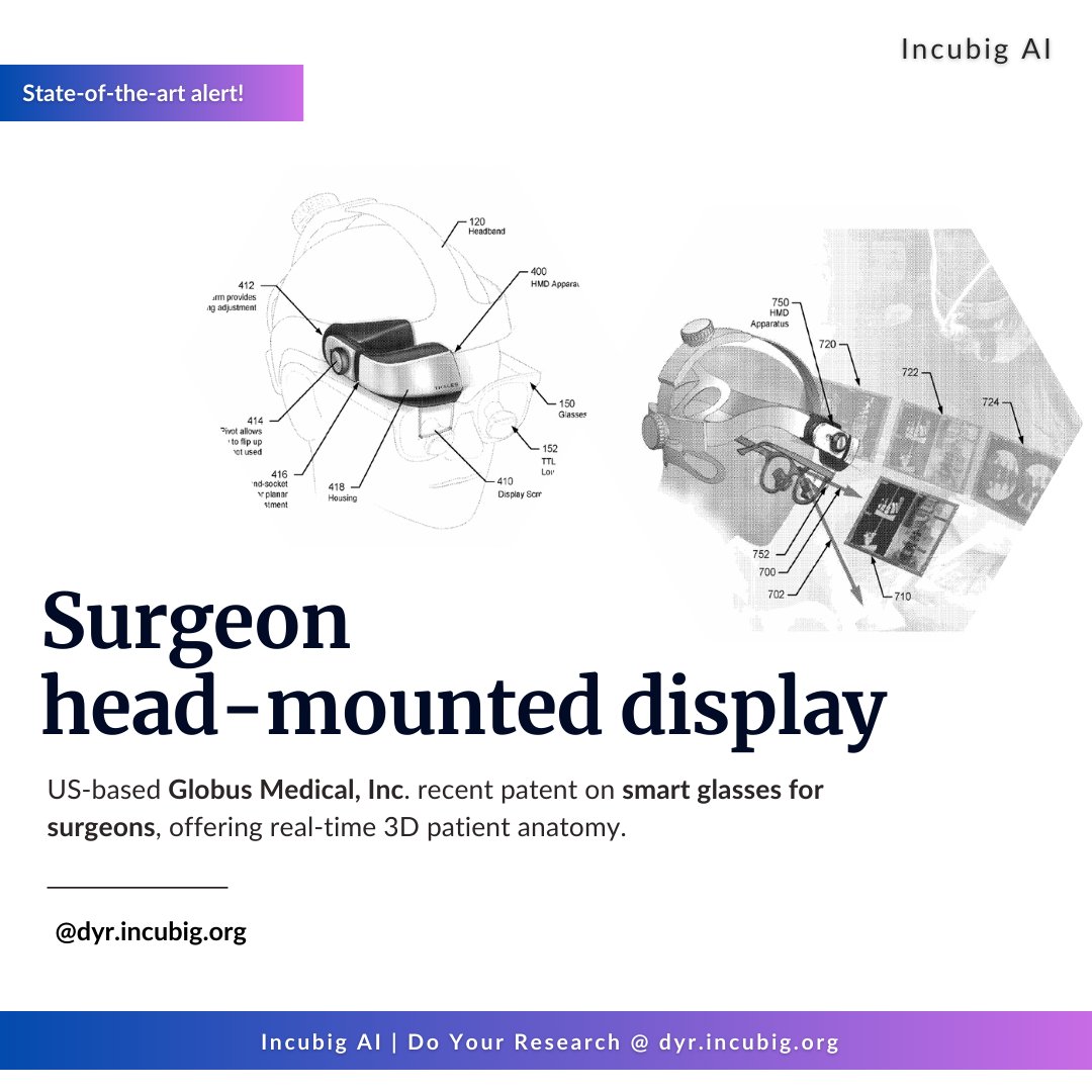 IncubigAI's tweet image. #Surgery just got a boost from @GlobusMedical  smart glasses – they move with the surgeon for precision! 

Explore the future of #MedicalTech. Do Your Research at dyr.incubig.org. 

#DYR #Incubig #incubigai
#Innovation #patents
#3DVisualization #HealthTech