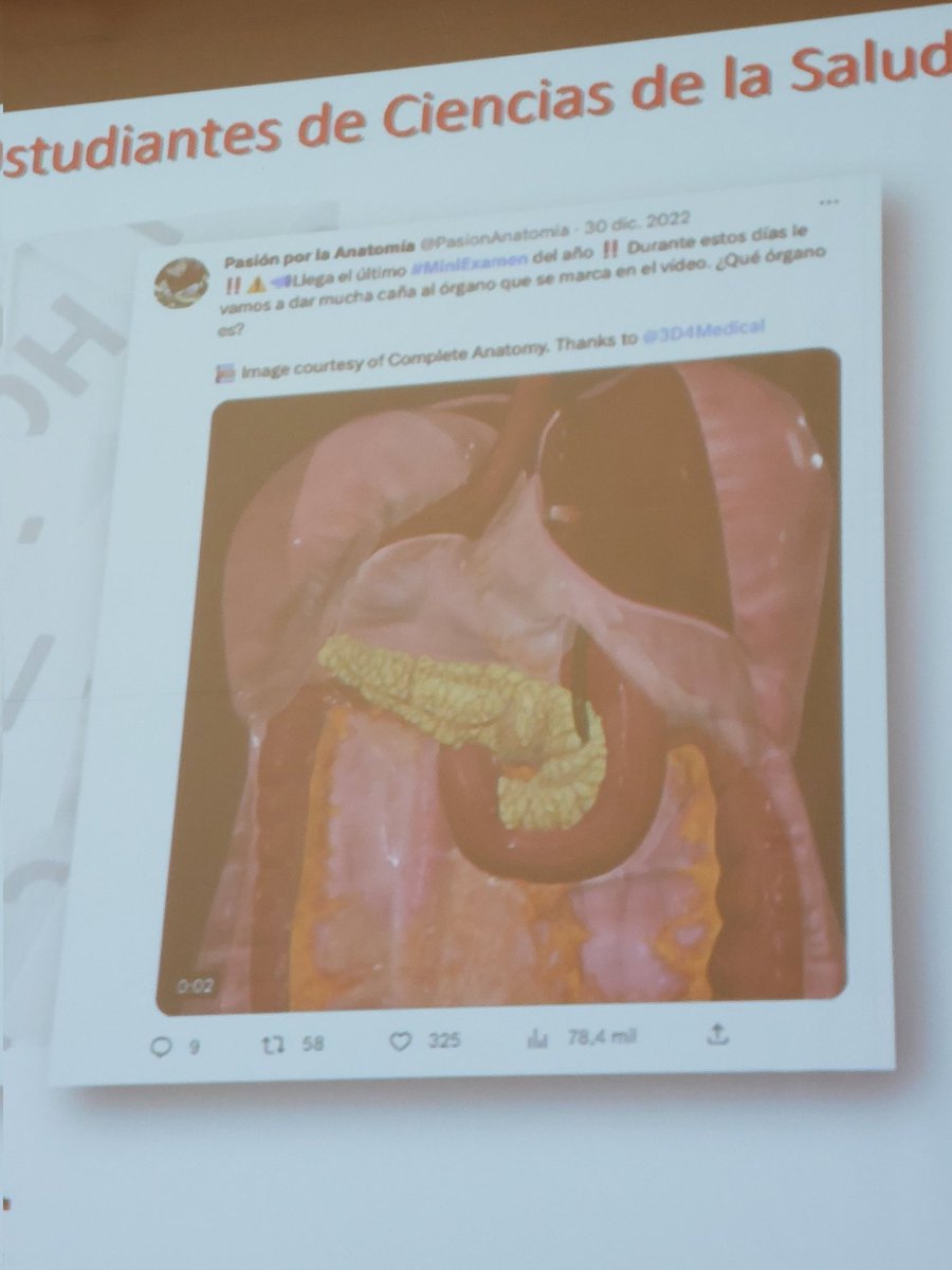 mlalanda's tweet photo. @rogaltro @PasionAnatomia Cada viernes, mini examen de anatomía!! #miniexamen
Y tambien #miniexamenpro
De @PasionAnatomia
#aebi23
Qué gran uso de RRSS!! https://t.co/exKSUJLh8s