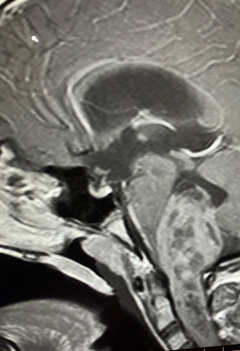 Som Biswas, MD(Rad), MS, MBA tweet media