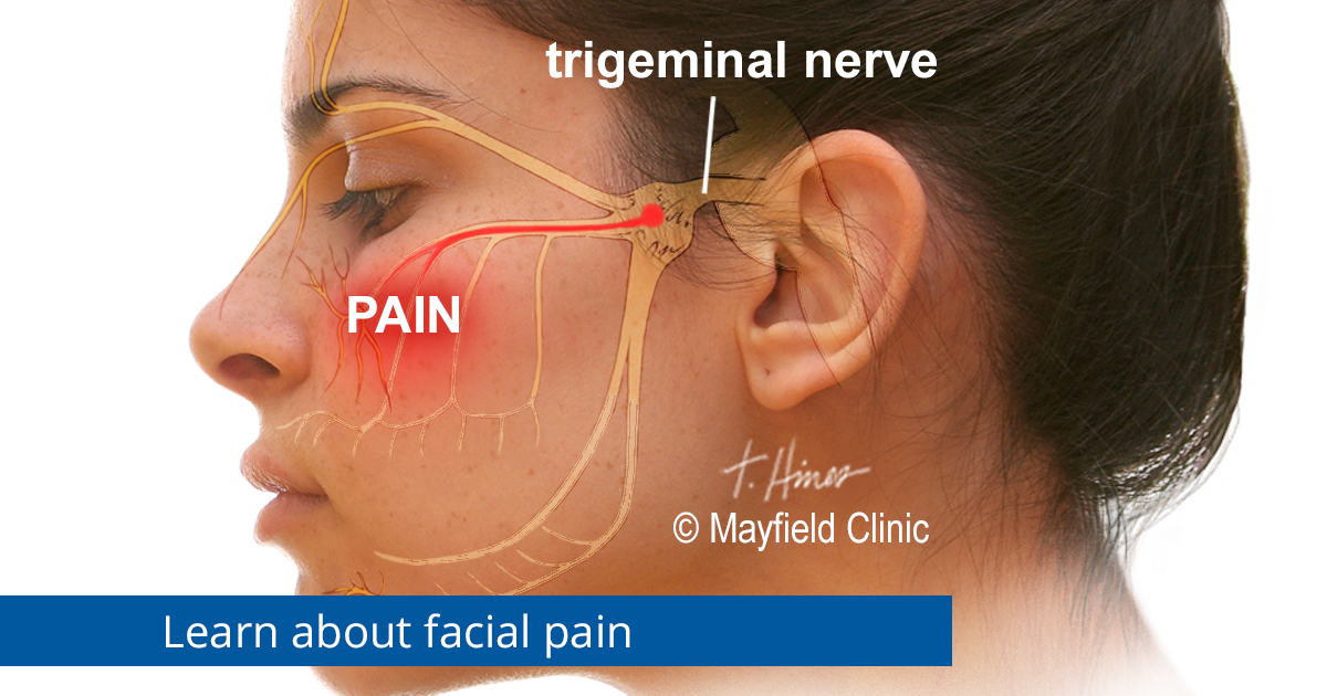 MayfieldClinic's tweet photo. Unexplained episodes of debilitating pain in the face can indicate trigeminal neuralgia. Mayfield has expertise in treatment of the disorder that originates from a short circuit within the trigeminal nerve. Learn more at https://t.co/5FnqsV494X. @facialpainassoc #facialpain https://t.co/pu8k7F4xrR