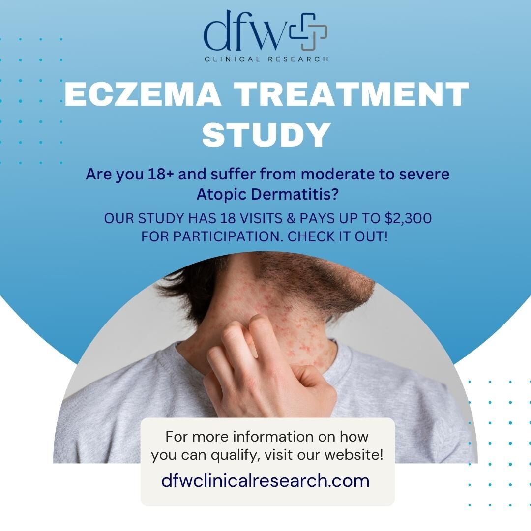 It's time to step away from the discomfort of atopic dermatitis! we're here to support you through the challenges and limitations. Learn more about our study and how you can be a part of it at dfwclinicalresearch.com 🌼💪

#GetPaid #GetPaid #eczemaresearch #atopicdermatitisstudy