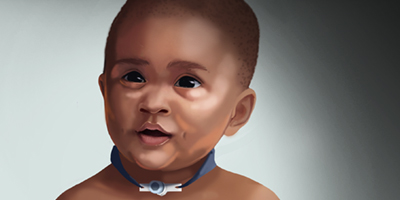 OPENPediatrics's tweet photo. Have you seen our new Clinical Image Library? We have almost a dozen images related to Medical Technologies. The images are free to use in your work with proper citations. https://t.co/oBewHh2FKa https://t.co/WTCzBMuf2r