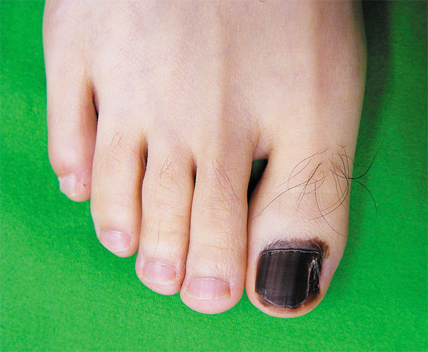 24pcs Fake Toe Nails Moon Star False Nails for Toe Artificial Full Cover  Nail Tips Foot Nails 12 Sizes, Black | Fruugo NO