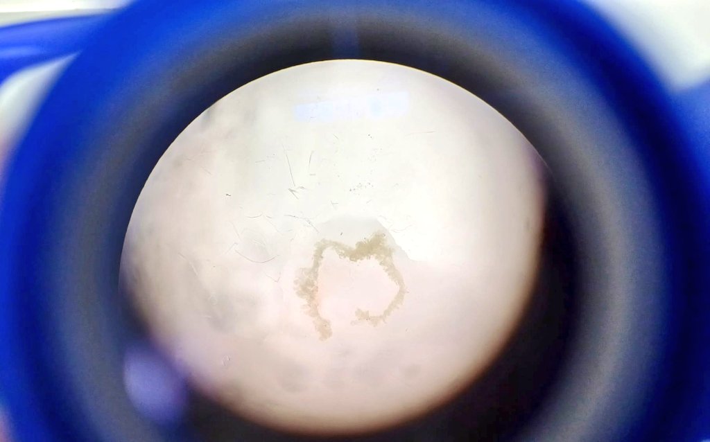 Daan Verhaege (@daanverhaege) on Twitter photo Today I performed my last choroid plexus sampling in the <a href="/Vdb_lab/">Vandenbroucke lab</a> to close out an amazing PhD experience π€ Soon we'll share our stories covering new fundamental insights on choroid plexus biology!! Today I performed my last choroid plexus sampling in the <a href="/Vdb_lab/">Vandenbroucke lab</a> to close out an amazing PhD experience π€ Soon we'll share our stories covering new fundamental insights on choroid plexus biology!!