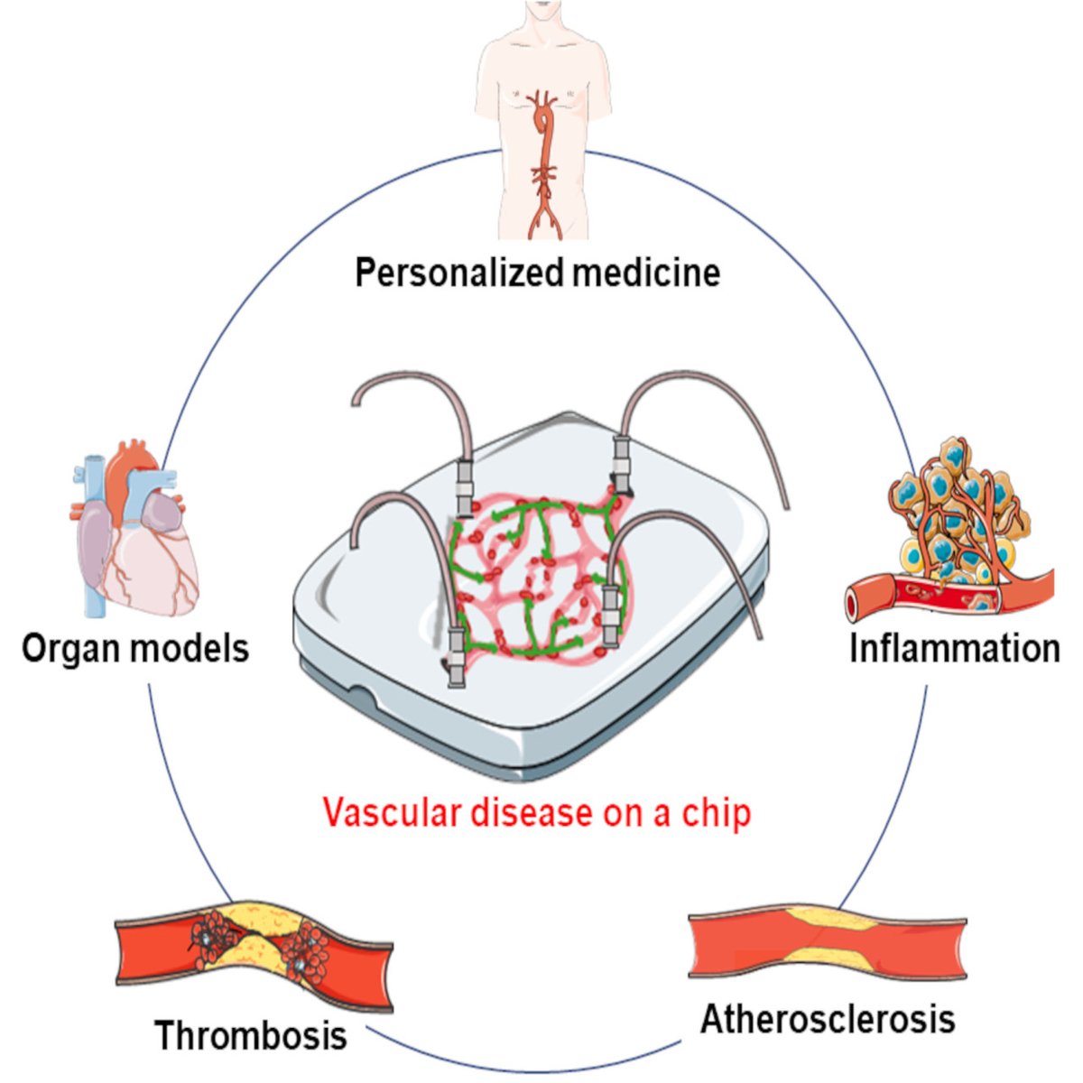 This review paper explores how organs-on-a-chip revolutionize the study of vascular diseases, offering
insights into drug discovery and personalized medicine
ahajrnls.org/3SfyEHN