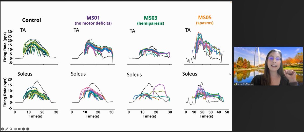 ricardoNOmesqui's tweet photo. #ISEKAroundTheWorld
@LauraMMcP just showed us some interesting qualitative and quantitative changes in the firing patterns of people living w/ #MultipleSclerosis 

⬇️firing hysteresis
⬆️⬇️variable acceleration and attenuation

Last session starts in 30 min
https://t.co/FNSjaRKgMC https://t.co/iU8wXyN5PU