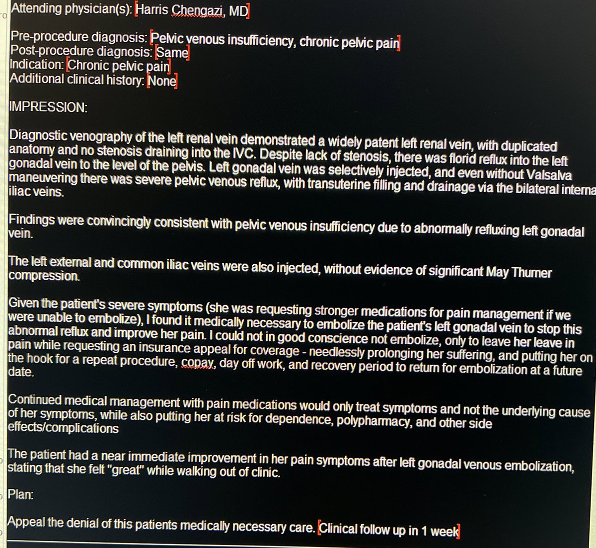 ChengaziMD's tweet image. It’s so silly we have to play this game. @UHC stop being obstructive, update your knowledge (see @SIRspecialists advocacy letter), and allow women to get the definitive tx for this well understood pathophysiologic process. 

#PeVD #womenshealth #medtwitter #HealthEquity #pain