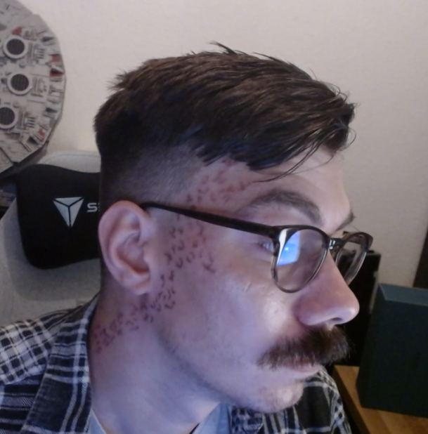 InQyyy's tweet image. Look a bit different now.
That Tat is a wish i had for a long time. It shows the nerve pathways where i have to deal with daily chronicle pain.
Lovely