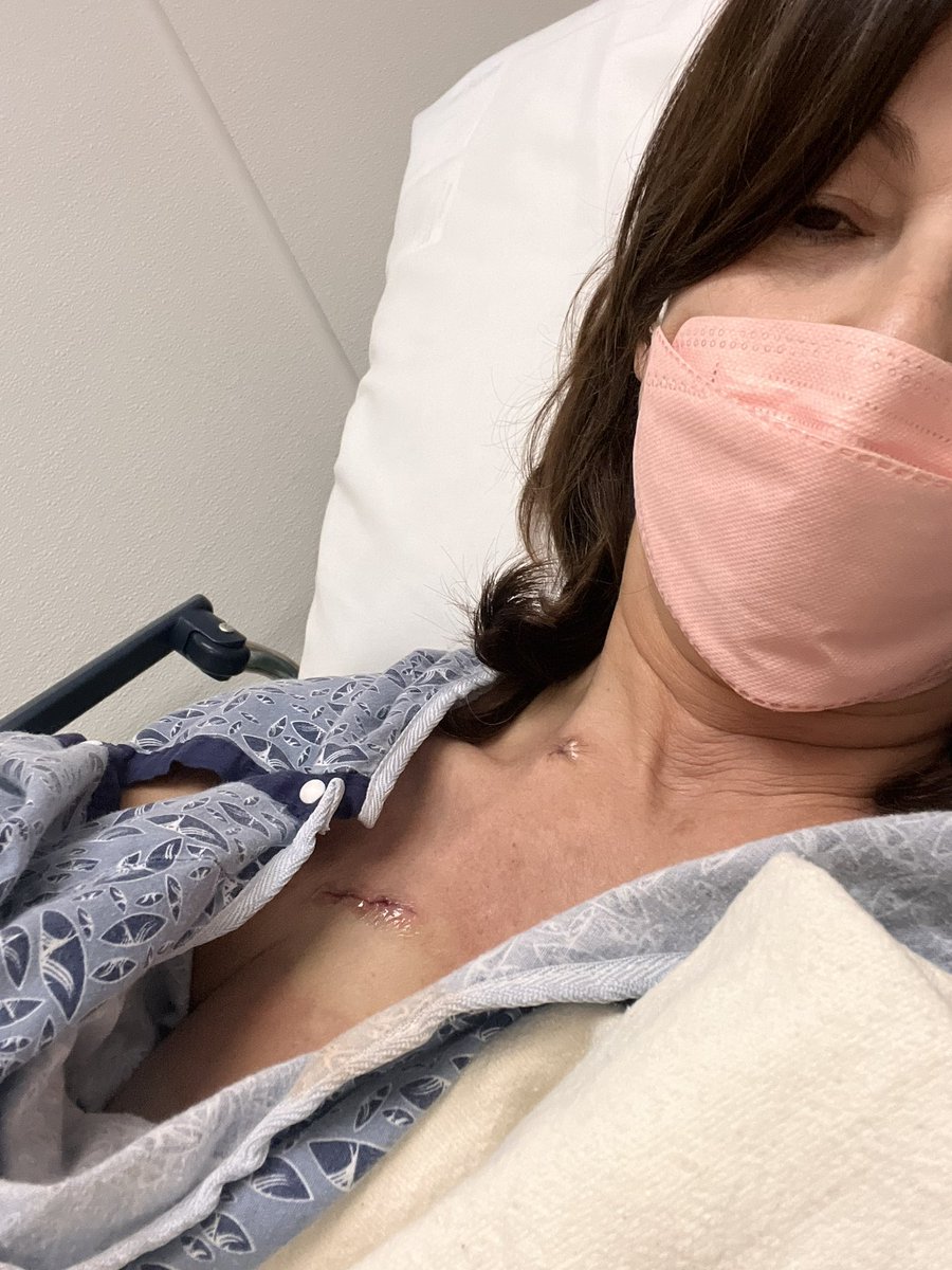 Port day!
The shit is real. 1st Chemo on Monday #BreastCancerAwareness #BreastCancerSucks #GetThoseBoobiesChecked #SelfCheck. #fuckCancer