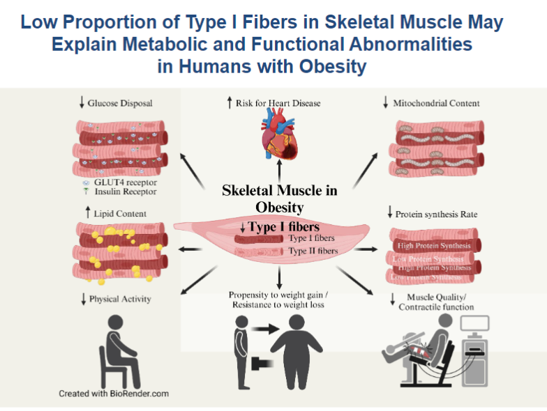 APSPublications's tweet photo. New in our #PhysiologyofObesity collection in @ajpendometab!
Muscle Fiber Phenotype: A Culprit of Abnormal #Metabolism and Function in Skeletal Muscle of Humans with #Obesity (Serrano et al.)
https://t.co/wffnnvSAAz
@asu #MuscleFiber #SkeletalMuscle https://t.co/1L09SMYn0P