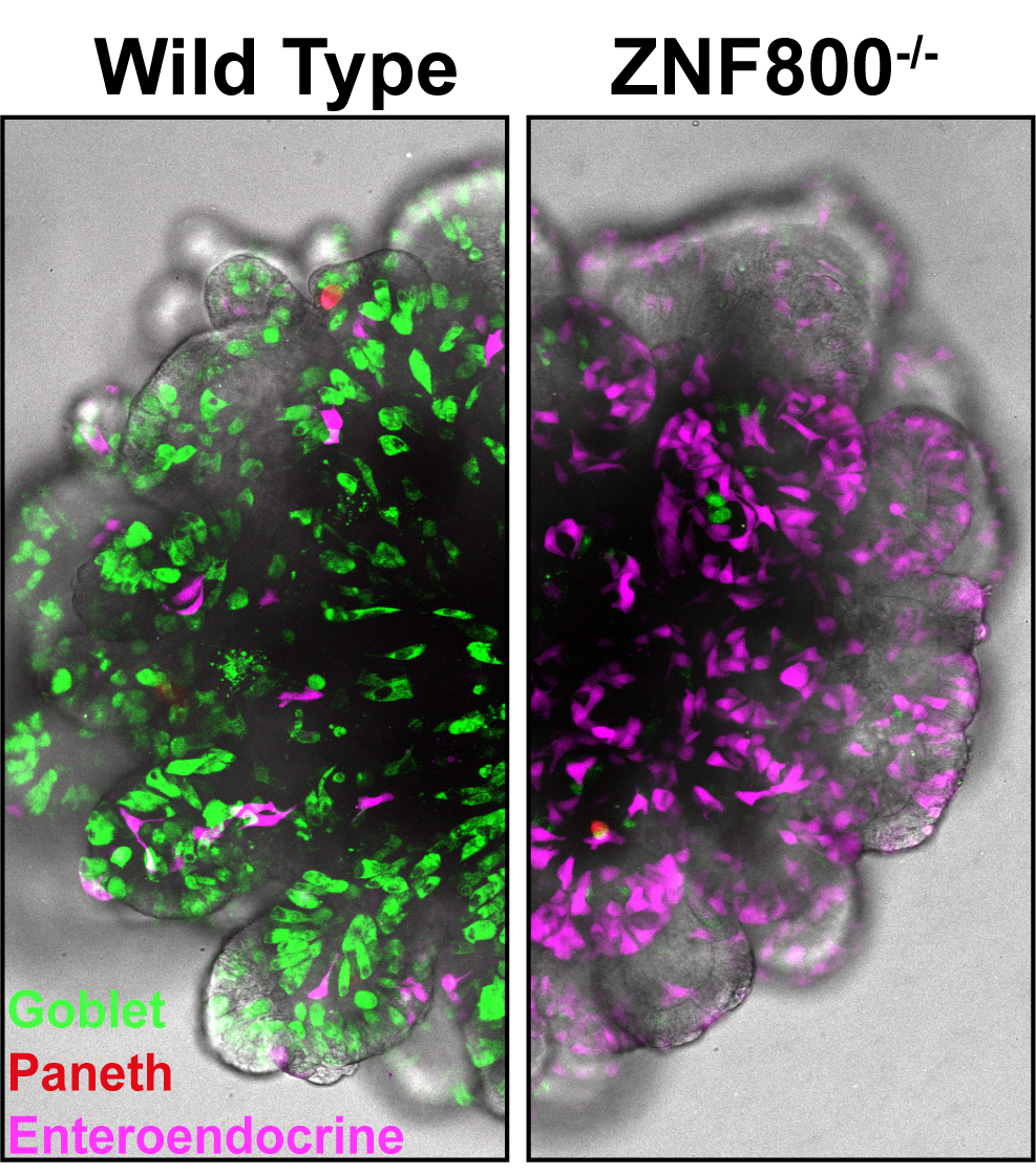 Hubrecht Institute (@_hubrecht) on Twitter photo How do stem cells form enteroendocrine cells of the gut? <a href="/TheCleversLab/">The Clevers Lab</a>, <a href="/prinsesmaximac/">PrinsesMáximaCentrum</a> and <a href="/MaastrichtU/">Maastricht University</a> used human gut organoids to answer that question and identified ZNF800 as a key regulator. The results were published in Science today!
Read more: hubrecht.eu/traffic-light-… How do stem cells form enteroendocrine cells of the gut? <a href="/TheCleversLab/">The Clevers Lab</a>, <a href="/prinsesmaximac/">PrinsesMáximaCentrum</a> and <a href="/MaastrichtU/">Maastricht University</a> used human gut organoids to answer that question and identified ZNF800 as a key regulator. The results were published in Science today!
Read more: hubrecht.eu/traffic-light-…