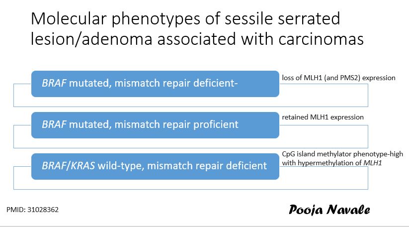 Sessile serrated lesion/adenoma caught in the act transforming into an invasive adenocarcinoma 

Please forgive me not adhering to the latest WHO nomenclature, posted for worldwide audience🙃

#PathTwitter #MedTwitter @wusm_pathology <a href="/washupathedu/">WashU Medicine Pathology & Immunology Education</a>