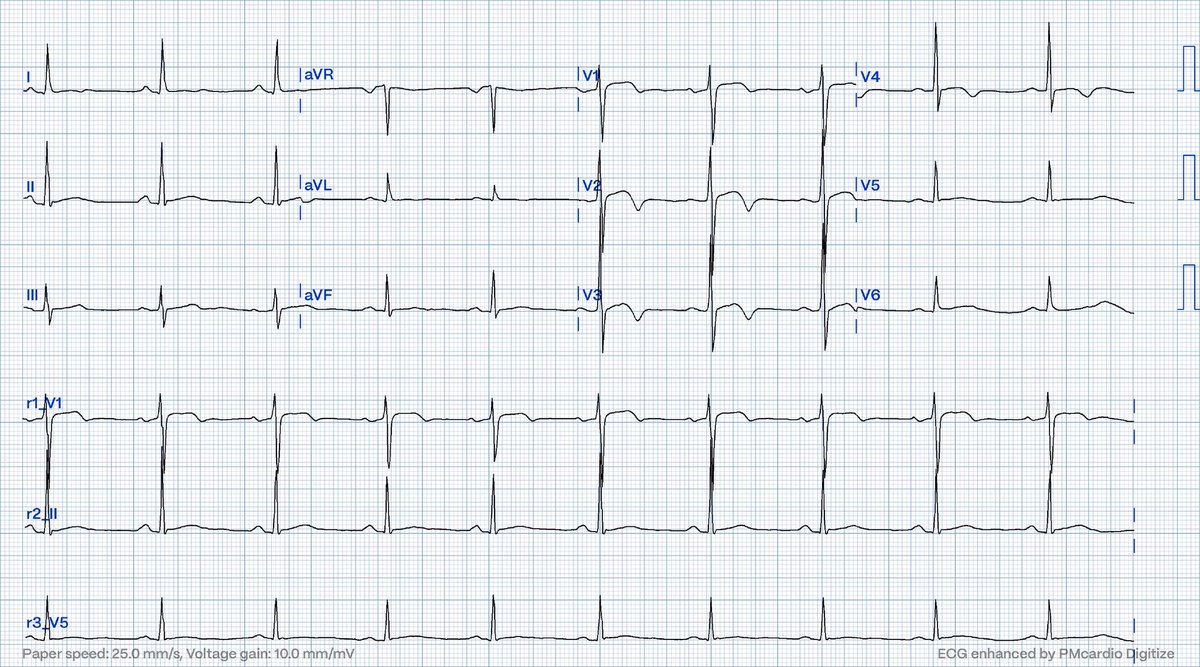 Willy Frick tweet media