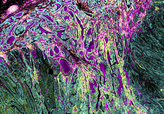 Standard_BioT's tweet photo. Get an exclusive preview of first-of-its-kind automation for tissue imaging and the addition of flexible imaging modes for faster and more in-depth profiling at #SITC23.
Sign up for one of the demos here: https://t.co/krQLZMIVG4
#proteomics #transciptomics https://t.co/XJQROEOlLx