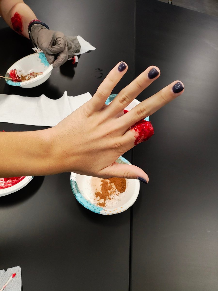 MidwayHS's tweet photo. Pathophysiology students are learning about skin disorders. Today they recreated wounds and burns as part of their case scenarios.
Lots of fun learning about wound complications, healing and treatment! https://t.co/udkH24qrCx