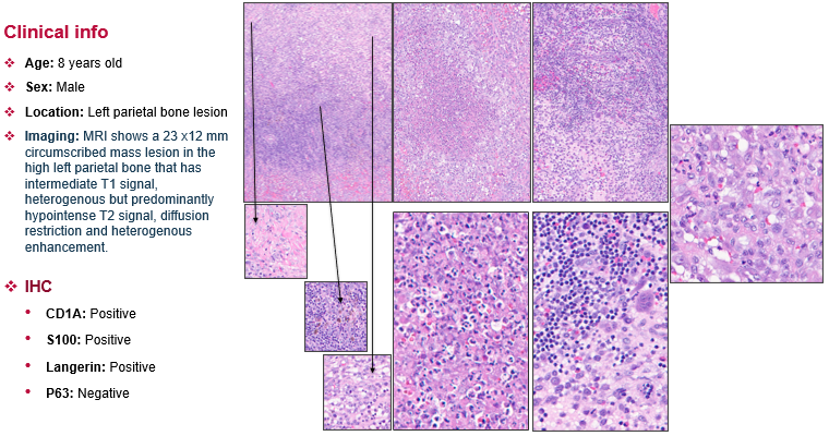 Kenneth Aldape, MD tweet media