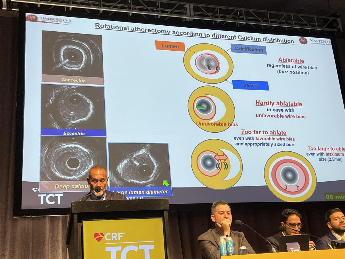stefan_harb's tweet image. Combination of #IVL and #rotablation 
Gennaro Sardella #TCT2023