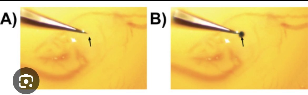 Thrilled to share our latest #publication on JoVE Journal <a href="/JoVEJournal/">JoVE</a> “Microinjection of Recombinant RCAS(A) Retrovirus into Embryonic Chicken Lens” Check it Out 😀!!!@JeanJiang17 <a href="/FrancyMAcosta/">Francisca Acosta</a>