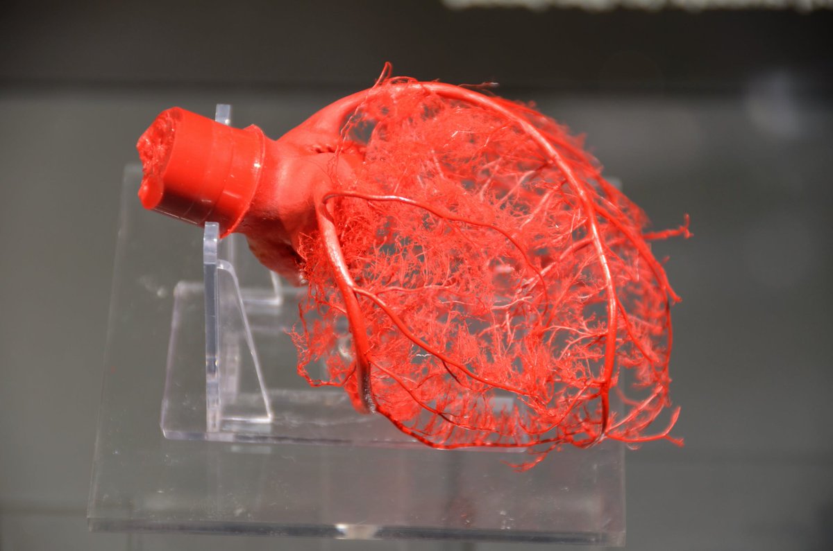 Endothelial Cell News (@endothelialnews) on Twitter photo Drs. Gilberto De Nucci and Roberto Zatz at <a href="/unicampoficial/">unicampoficial</a> propose that #endothelium-derived catecholamines may constitute a major mechanism for control of #vascular tone and 💓 #heart functions!
📖 #Review | bitly.ws/YwVc Drs. Gilberto De Nucci and Roberto Zatz at <a href="/unicampoficial/">unicampoficial</a> propose that #endothelium-derived catecholamines may constitute a major mechanism for control of #vascular tone and 💓 #heart functions!
📖 #Review | bitly.ws/YwVc