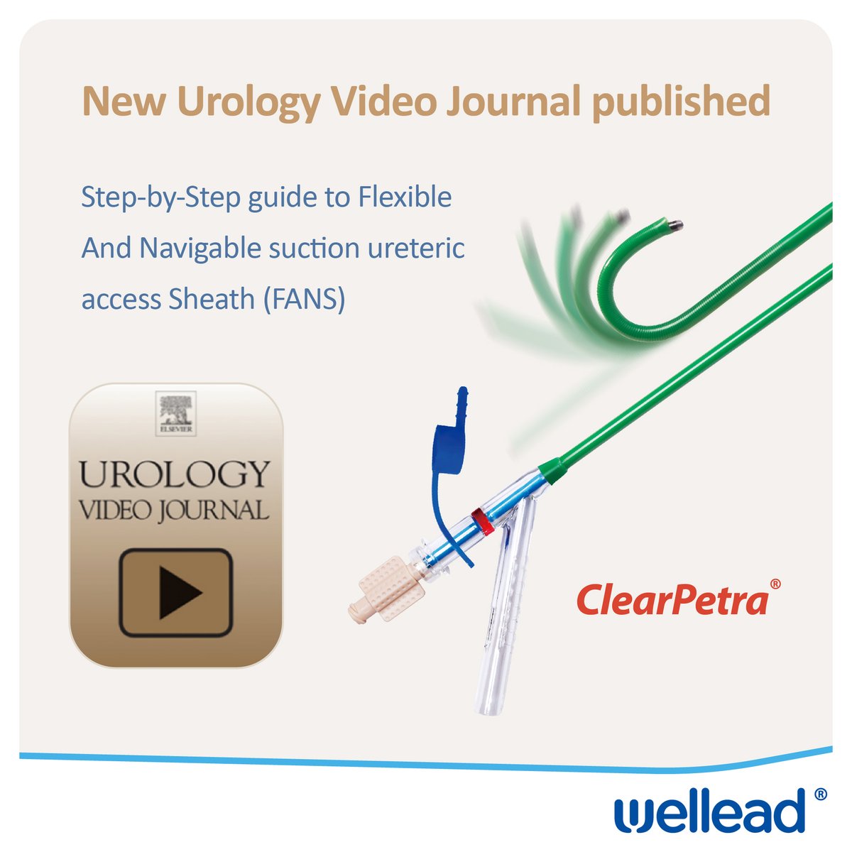 We are pleased to announce that Dr. Vineet Gauhar together with esteemed doctors from different centers globally, has published a study about the flexible and navigable suction ureteral access sheath. For more details, please click the link: lnkd.in/eSRC7FhR.