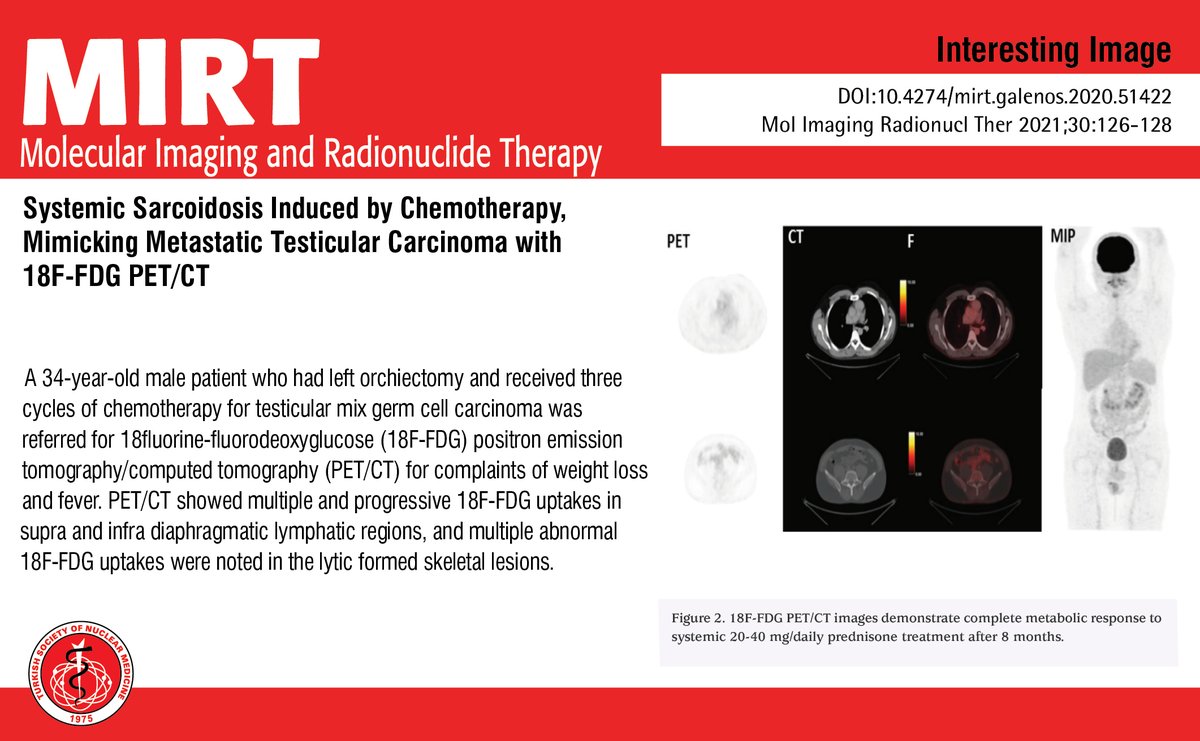 MIRTOfficial's tweet photo. Systemic Sarcoidosis Induced by Chemotherapy, Mimicking Metastatic Testicular Carcinoma with 18F-FDG PET/CT

You can see the free full text of the research by Esra Arslan et al.

Link : https://t.co/N65Lgn3yGv

#Systemicsarcoidosis #testis #carcinoma https://t.co/2HebbLxImb