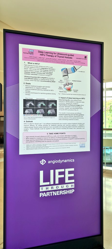 ng4helen's tweet photo. At the @angiodynamics symposium with @TzeWah1 and Lewis his work at @UniversityLeeds funded by @UKRI_News as one of the finalists for Young Investigator Prize! An honour to represent the team for the project! @LeedsHospitals https://t.co/b9fEubOwoH