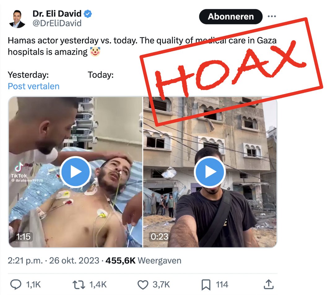 JPeterBurger's tweet photo. Alweer een virale hoax over een Palestijnse 'crisisacteur'. De man in het ziekenhuisbed verloor in juli een been bij een Israëlische inval in een kamp op de Westbank, de man rechts loopt nog steeds op twee benen door Gaza. Factcheck: https://t.co/9tjaaCjXPh 1/3 https://t.co/aU5dtKMldR