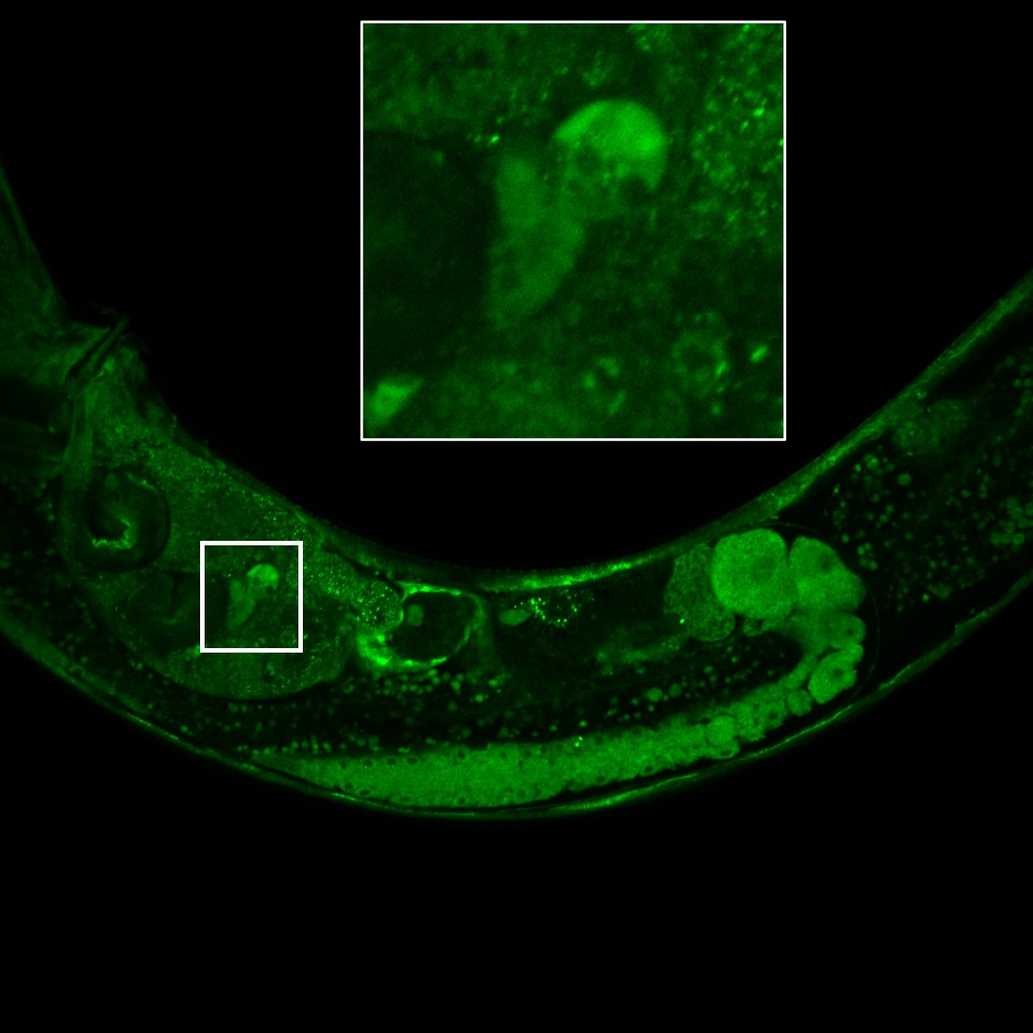 MedBiotechAAU's tweet photo. Normal looking #Celegans - or incubator for a demon baby?! 😱😈 Spooky imaging by MSc student  @Vidthdyan 🔬🎃🪦

#microscreepy #halloween #FluorescenceFriday https://t.co/d8ylddjnpL