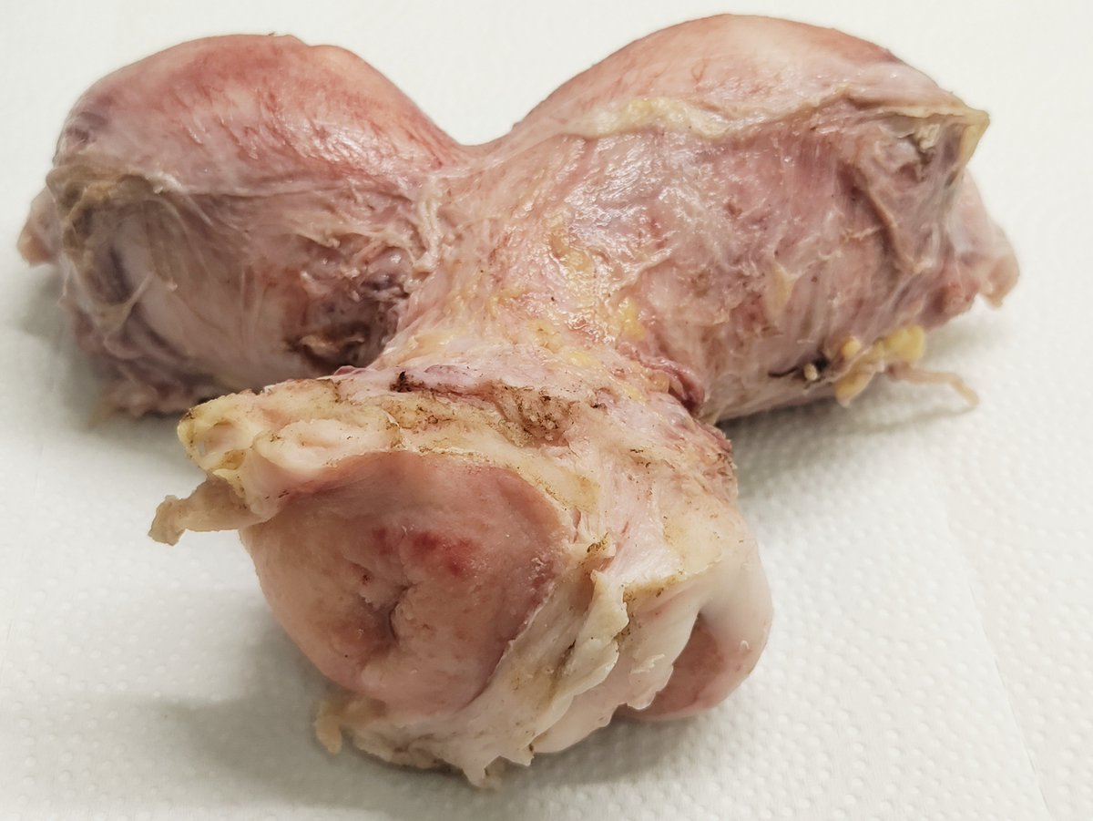 ASADDIWAN1's tweet photo. Uterus didelphys a rare congenital condition, commonly called a double uterus. #GynPath  @UMichPath  @CaDxPath  @TeamCaptainJohn 
@KayParkMD @Roma_GYNPath @AnneMillsMD @KMirza @sahar0493 @ahsanuitis
 #TwitterHomework #PathElective https://t.co/wAhkVgUyVK