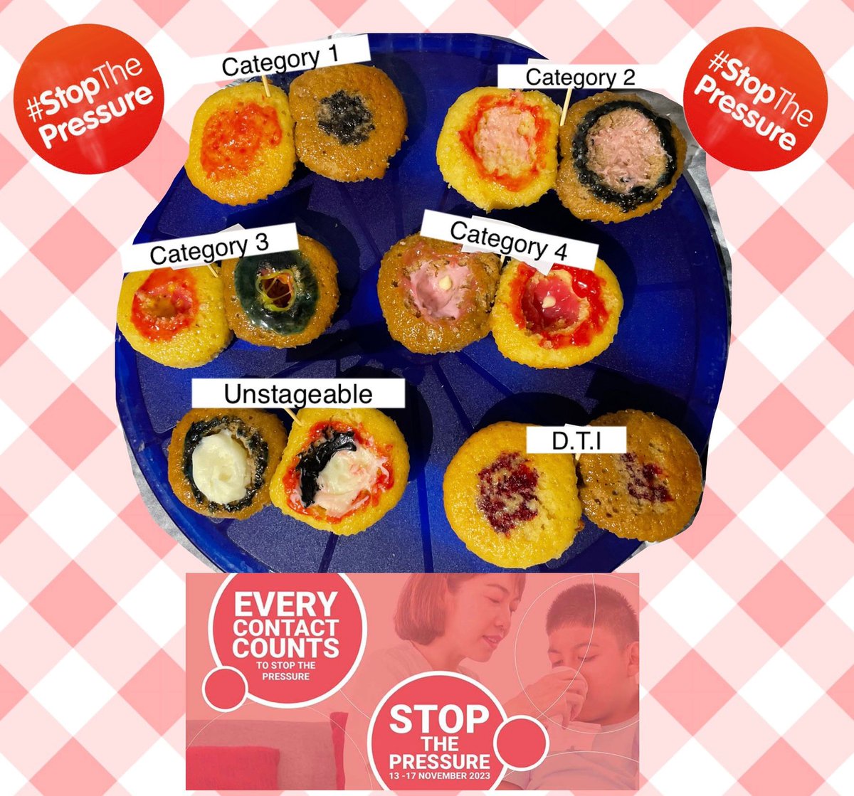Don’t forget to enter the ‘Great <a href="/NottsHealthcare/">Nottinghamshire Healthcare</a> Bake off’ to raise awareness for WSTPD! <a href="/MichelleS_C/">Michelle Smith-Cockayne</a> excellent PU buns - you are definitely this weeks star baker! ⭐️ <a href="/EPUAP1/">EPUAP</a> <a href="/TVN2gether1/">TVN2gether</a> <a href="/SoTV_UK/">Society of Tissue Viability</a> <a href="/Lizelrand/">El - RGN, BSc (Hon), MSc, IP (V300)</a> <a href="/hayley_darn/">Hayley Darn</a> 🙌