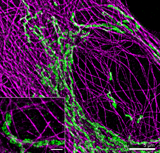 oniHQ's tweet photo. 🎨 dSTORM can resolve the tubulin cytoskeleton beautifully! Cells stained using ONI's #DiscoveryKit with Strong fixative using TOMM20+CF583R (green) &amp; tubulin+AZ647 (magenta), which simplifies #sampleprep! #FluorescenceFriday #Nanoimager

Read on our kits: https://t.co/YX87fMMG5e https://t.co/HVzDSlVjzK