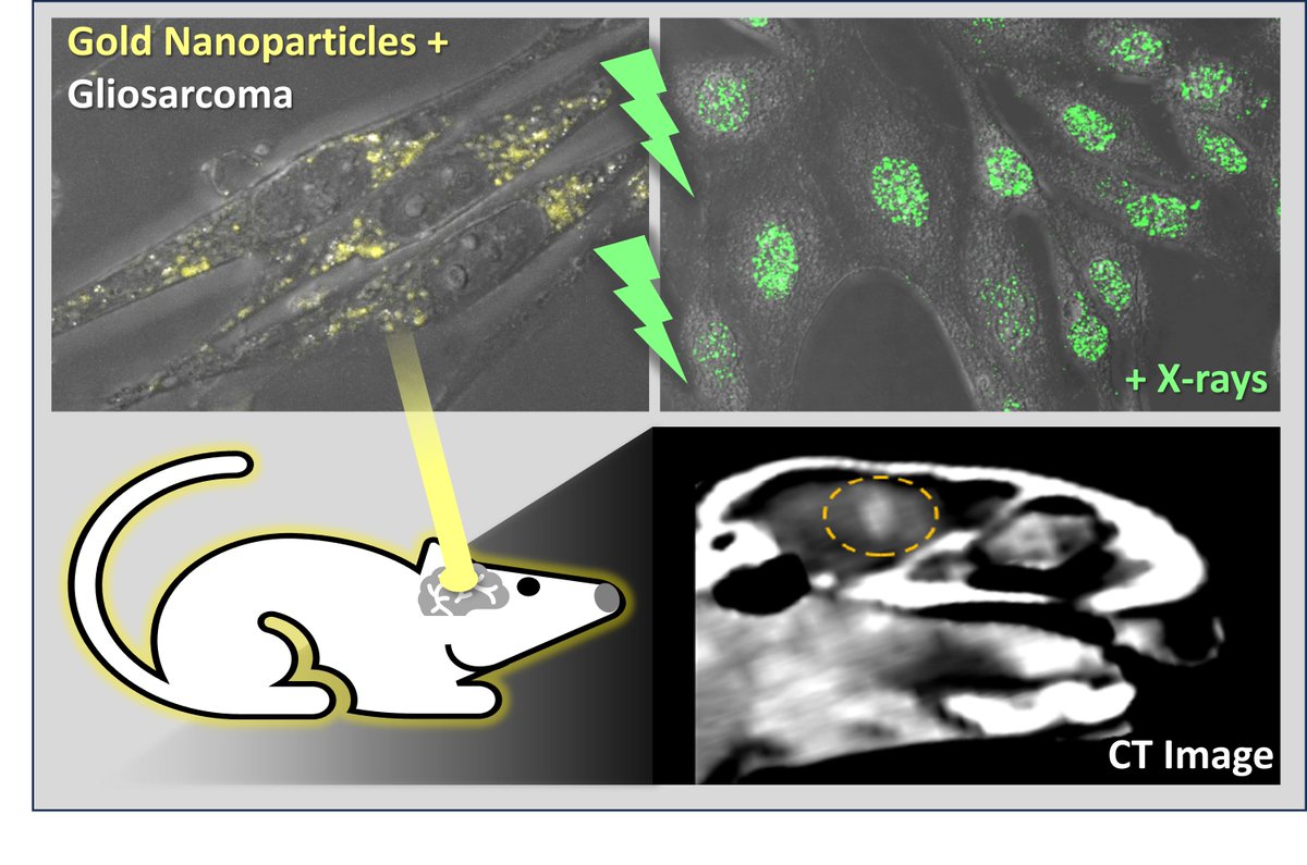 Journal of Nanotheranostics MDPI (@jnt_mdpi) on Twitter photo 💡New #mdpijnt publication!
🔔"Efficacy of 15 nm #Gold #Nanoparticles for #Image-Guided #Gliosarcoma #Radiotherapy" by Engels, E. et al. <a href="/EletteEngels/">Elette Engels</a> <a href="/Tehei_Moeava/">Moeava Tehei</a> <a href="/Stephanie_Corde/">Stéphanie Corde</a>
🔎 The full article is available at: t.ly/9VLD3
Enjoy reading!
#OpenAccess 💡New #mdpijnt publication!
🔔"Efficacy of 15 nm #Gold #Nanoparticles for #Image-Guided #Gliosarcoma #Radiotherapy" by Engels, E. et al. <a href="/EletteEngels/">Elette Engels</a> <a href="/Tehei_Moeava/">Moeava Tehei</a> <a href="/Stephanie_Corde/">Stéphanie Corde</a>
🔎 The full article is available at: t.ly/9VLD3
Enjoy reading!
#OpenAccess