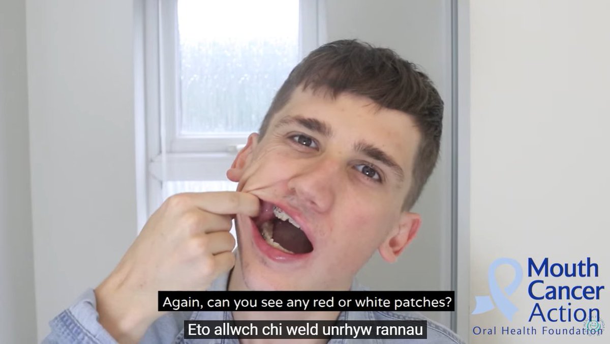 mouthcancerorg's tweet photo. 🏴󠁧󠁢󠁷󠁬󠁳󠁿We're really pleased to be able to offer Welsh subtitles on our mouth cancer home check video, thanks to a kind volunteer from Public Health Wales.

Use this link to see for yourself! 

https://t.co/viJiCmp2zY https://t.co/gAZtl7STj0