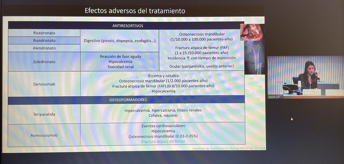 Verareuma's tweet photo. Excel.lent exposició de la Dra @helena_florezz sobre el tractament per l’osteoporosi, en el #masterclassOP @althaiamanresa #reumalthaia https://t.co/nkSAvm3p6u