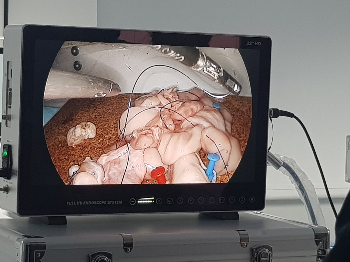 N_Raj_'s tweet photo. Great #GenSurg training day for regional trainees in #PeninsulaDeanery. Lap suturing, bowel anastomoses &amp; more! Running more of these courses throughout the year...come to the sunny SouthWest for more! @Surgi1Courses @SWSTN @TorbaySDevonNHS @bowling_kirk @ASiTofficial https://t.co/F5GCcpZcoO