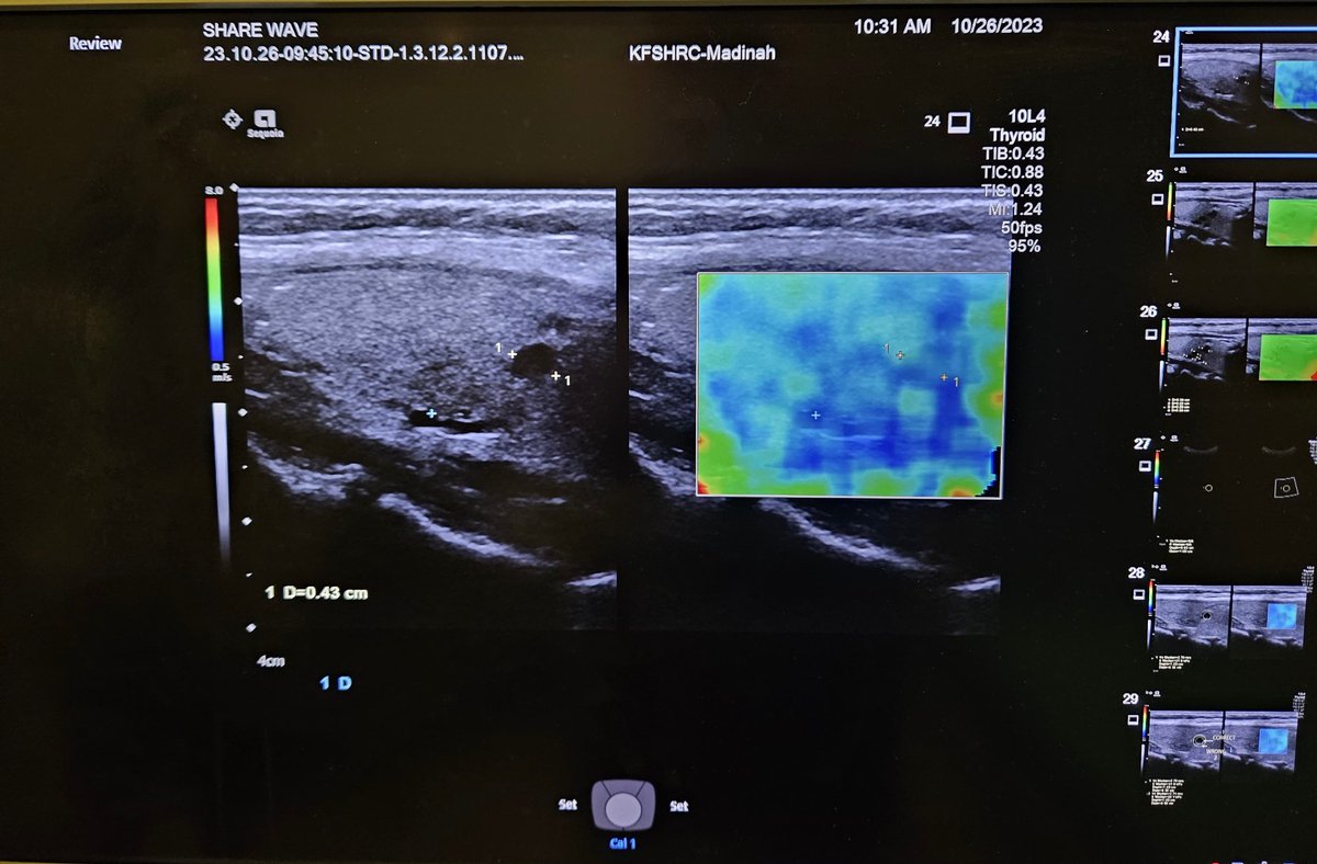 Finalized our #Elastography training for our Ultrasound Techs, Abdominal Radiologists and #Radiology Specialists &amp; officially launched the service 

#KFSHRC_M