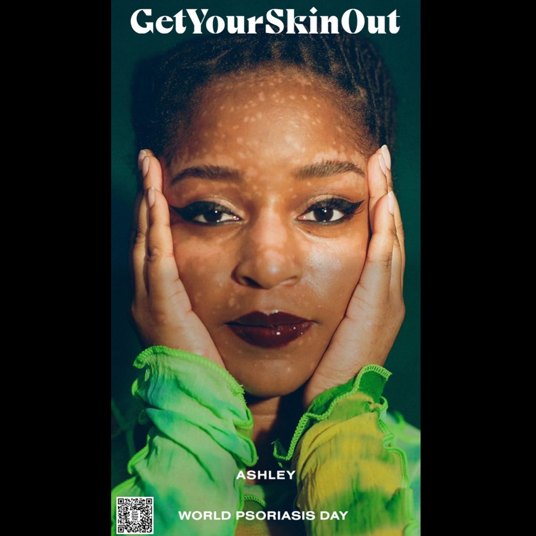 GetYourSkinOut tweet media