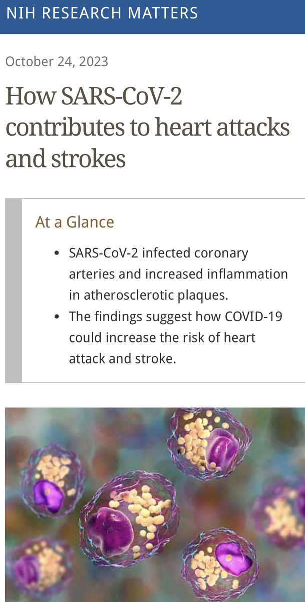 sandralopezleon's tweet photo. 🦠 #COVID aumenta el riesgo de infarto cerebral y cardíaco.
➡️El virus afecta a los macrófagos
➡️Los macrófagos eliminan patógenos y ayudan a eliminar el colesterol de los vasos sanguíneos
➡️Por lo tanto hay aumento de aterosclerosis e inflamación

https://t.co/VJPl5RTgmd https://t.co/sZJAb6Kl5A