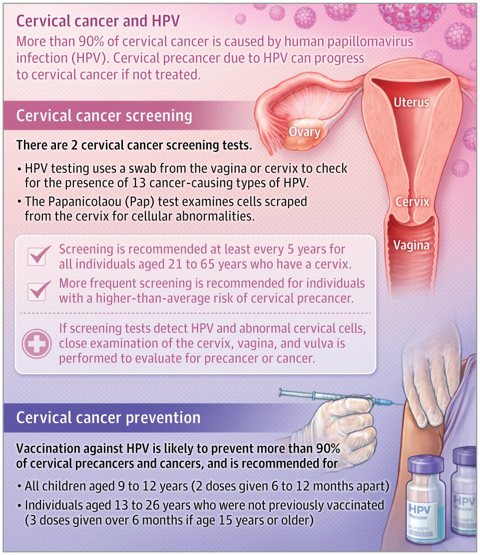 JAMA_current's tweet photo. More than 90% of cervical cancers are caused by human papillomavirus (HPV) infection. This JAMA Patient Page discusses screening for cervical cancer, including who should be screened, recommendations for handling positive results, and the prevention. https://t.co/ax1P81p64r https://t.co/eOQqwOJUpd