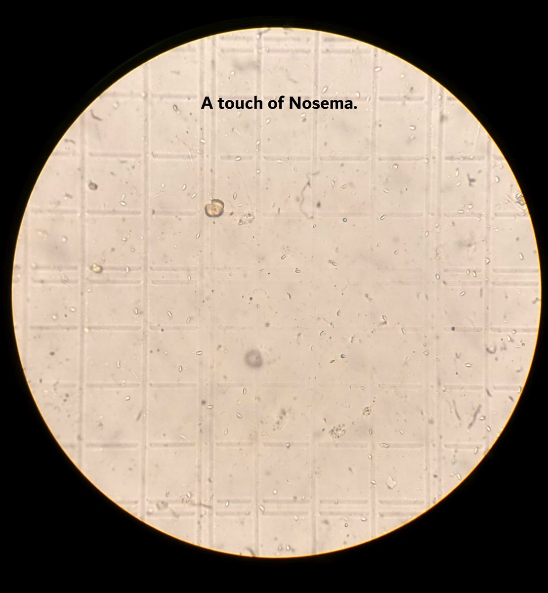 MudSongs's tweet photo. I just tested one of my colonies for Nosema, the common cold of honey bees. It's got a touch of Nosema (the little rice-like spores), but I'm not concerned. It's a large healthy colony with a tonne of honey. I predict it will get through the winter just fine.

#beekeeping https://t.co/ASl4i3K2ix