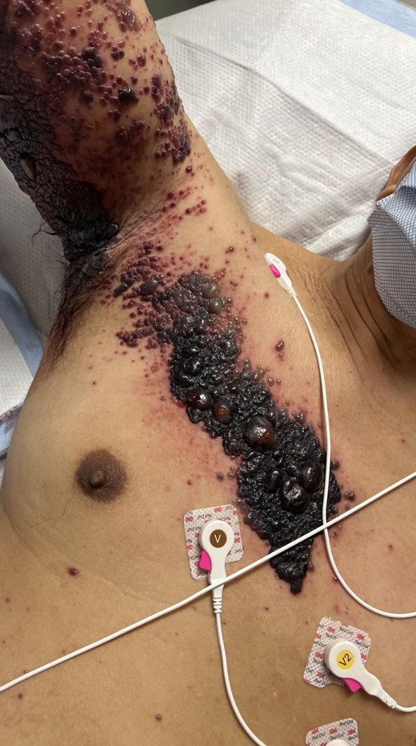 drsamshuaibi's tweet photo. Can you guess what this is?🤔🤔

Best answer will be noted👏🏻🥰
#Usmle #DrSam👩🏼‍⚕️🩺 #medtwitter #match2024 #match2023 #ecfmg #ecfmgcertificate https://t.co/RqKFf2f9n1