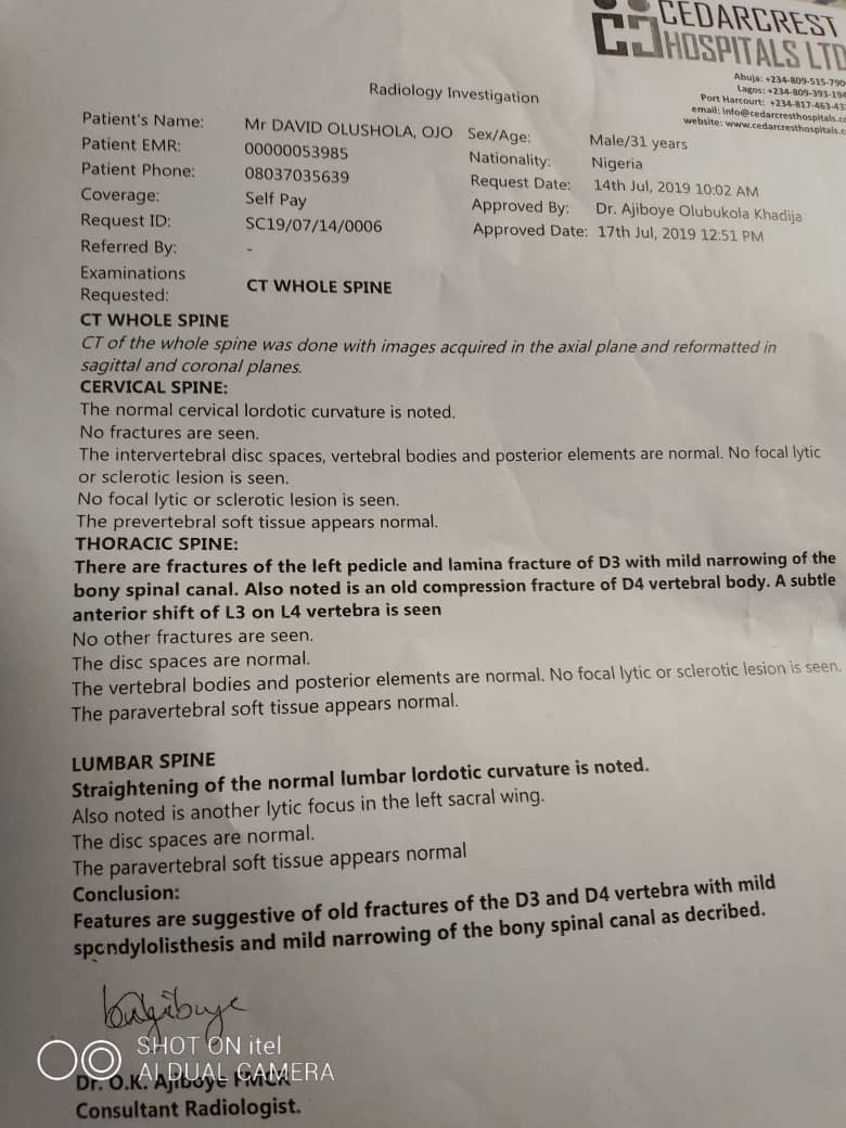 olusola2222's tweet photo. Please come to my rescue it's been 4yearw I had this accident just a month after my accident and it's been difficult to walk, pupu or do anything. Please some friends came to get to help me get surgery in Thailand and the cost of surgery is #15 million. Please I need help. https://t.co/kjGHsAWmt6