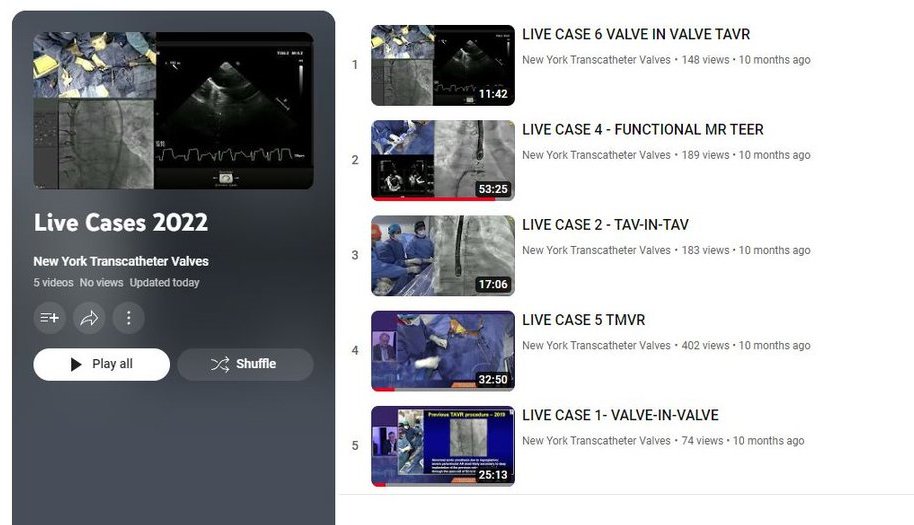 View the incredible live case catalog from last year's 2022 NYTV Symposium on YouTube! FEATURING: TMVR, MR TEER, Valve-in-Valve TAVR, & more! youtube.com/playlist?list=… Register Now for More Exemplary Structural Heart Cases LIVE from Mount Sinai Hospital nytranscathetervalves.org/registration-i…